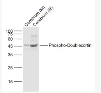 Anti-Phospho-Doublecortin (Ser47) antibody-磷酸化双皮质素抗体,Phospho-Doublecortin (Ser47)