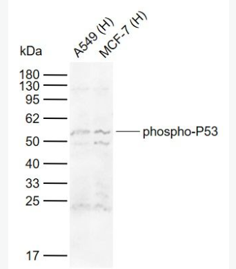 Anti-phospho-P53 (Ser15) antibody-磷酸化肿瘤抑制基因P53抗体,phospho-P53 (Ser15)