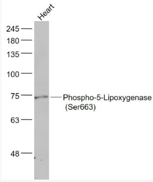 Anti-Phospho-ALOX5 (Ser663) antibody-磷酸化5-脂氧合酶抗体,Phospho-ALOX5 (Ser663)