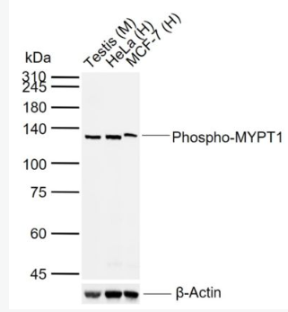 Anti-Phospho-MYPT1 (Thr696) antibody-磷酸化肌球蛋白磷酸酶抗体,Phospho-MYPT1 (Thr696)