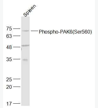 Anti-Phospho-PAK6 (Ser560) antibody-磷酸化p21激活激酶6抗体,Phospho-PAK6 (Ser560)