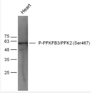 Anti-Phospho-PFKFB3/PFK2 (Ser467) antibody-磷酸化果糖-2,6-二磷酸酶3/磷酸果糖激酶2抗體,Phospho-PFKFB3/PFK2 (Ser467)