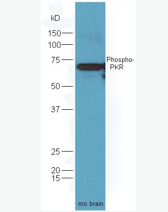 Anti-Phospho-PKR (Thr446) antibody-磷酸化干扰素诱导的双链RNA活化蛋白激酶抗体,Phospho-PKR (Thr446)