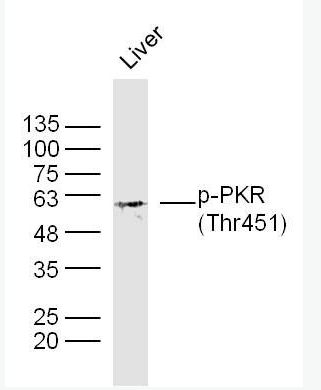 Anti-phoPhospho-PKR (Thr451)antibody-磷酸化干扰素诱导的双链RNA活化蛋白激酶抗体,Phospho-PKR (Thr451)