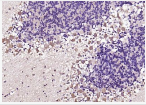 Anti-Phospho-PSD95 (Tyr236 + Tyr240) antibody-磷酸化突触后密度蛋白95抗体,Phospho-PSD95 (Tyr236 + Tyr240)