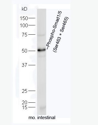 Anti-Phospho-Smad1/5 (Ser463 + Ser465) antibody-磷酸化细胞信号转导分子Smad-1/5抗体,Phospho-Smad1/5 (Ser463 + Ser465)