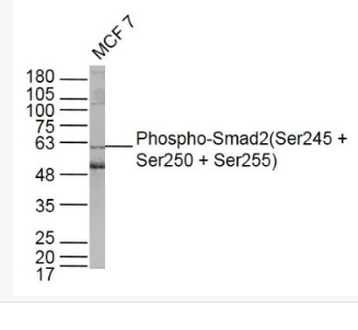 Anti-Phospho-Smad2 (Ser245 + Ser250 + Ser255) antibody-磷酸化细胞信号转导分子SMAD2抗体,Phospho-Smad2 (Ser245 + Ser250 + Ser255)