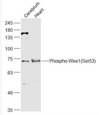 Anti-Phospho-Wee1 (Ser53) antibody-磷酸化WEE1蛋白抗体,Phospho-Wee1 (Ser53)