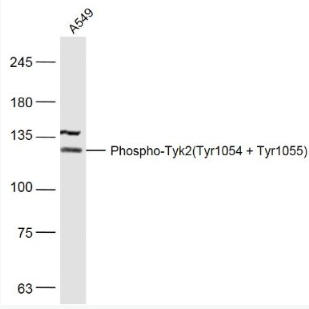 Anti-Phospho-Tyk2 (Tyr1054 + Tyr1055) antibody-磷酸化非受体酪氨酸蛋白激酶2抗体,Phospho-Tyk2 (Tyr1054 + Tyr1055)