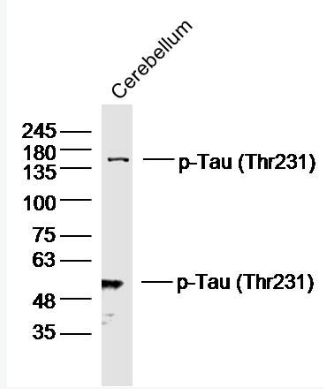 Anti-phospho-Tau (Thr231) antibody-磷酸化微管相关蛋白抗体,phospho-Tau (Thr231)