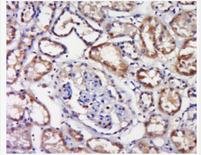 Anti-Phospho-TAK1 (Ser192) antibody-磷酸化转化生长因子β活化激酶1,Phospho-TAK1 (Ser192)