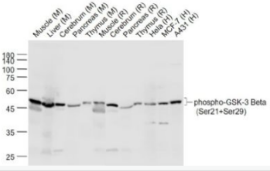 Anti-phospho-GSK-3 Beta (Ser21+Ser29) antibody-磷酸化糖原合酶激酶3β抗體,phospho-GSK-3 Beta (Ser21+Ser29)