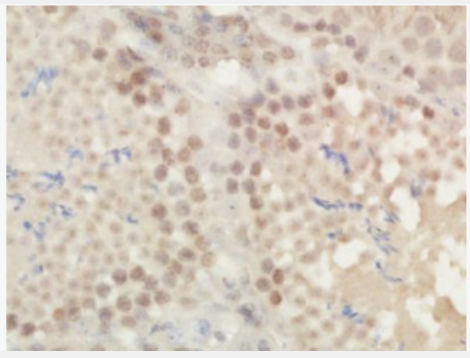 Anti-phospho-ROCK2 (Tyr256) antibody-磷酸化Rho相關(guān)蛋白激酶2抗體,phospho-ROCK2 (Tyr256)