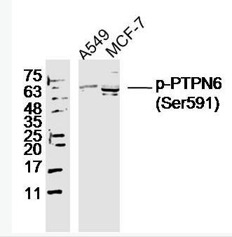 Anti-phospho-PTPN6 (Ser591) antibody-磷酸化蛋白酪氨酸磷酸酶1C抗体,phospho-PTPN6 (Ser591)