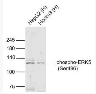 Anti-phospho-ERK5 (Ser496) antibody-磷酸化细胞外信号调节激酶5抗体,phospho-ERK5 (Ser496)