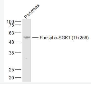 Anti-Phospho-SGK1 (Thr256) antibody-磷酸化糖皮质激素调节激酶1抗体,Phospho-SGK1 (Thr256)