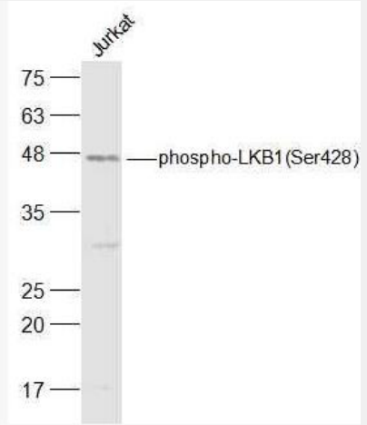 Anti-phospho-LKB1 (Ser428) antibody-磷酸化丝氨酸/苏氨酸蛋白激酶抗体,phospho-LKB1 (Ser428)