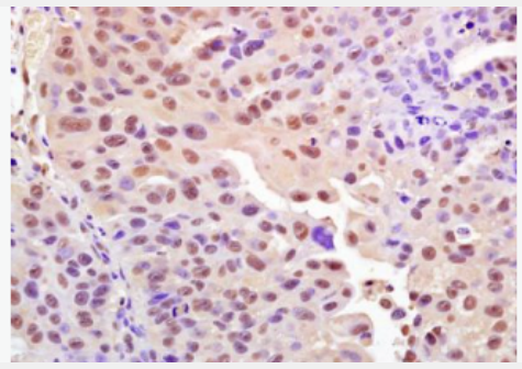 Anti-Phospho-H2AX (Ser139) antibody-磷酸化组蛋白H2AX抗体,Phospho-H2AX (Ser139)