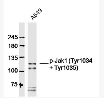 Anti-Phospho-Jak1 (Tyr1034 + Tyr1035) antibody-磷酸化蛋白质酪氨酸激酶JAK-1抗体,Phospho-Jak1 (Tyr1034 + Tyr1035)