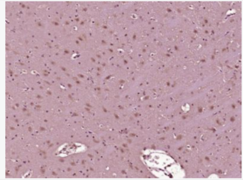 Anti-phospho-AMPK beta 1 + AMPK beta 2 (Ser182/Ser184) antibody-磷酸化腺苷单磷酸活化蛋白激酶β1抗体,phospho-AMPK beta 1 + AMPK beta 2 (Ser182/Ser184)