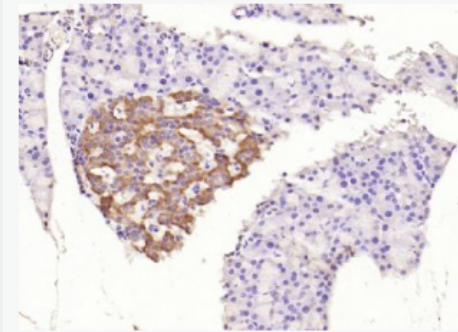 Anti-phospho-IRS1 (Ser312) antibody-磷酸化胰島素受體底物-1抗體,phospho-IRS1 (Ser312)