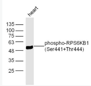 Anti-phospho-RPS6KB1 (Ser441+Thr444) antibody-磷酸化核糖体S6蛋白激酶抗体,phospho-RPS6KB1 (Ser441+Thr444)