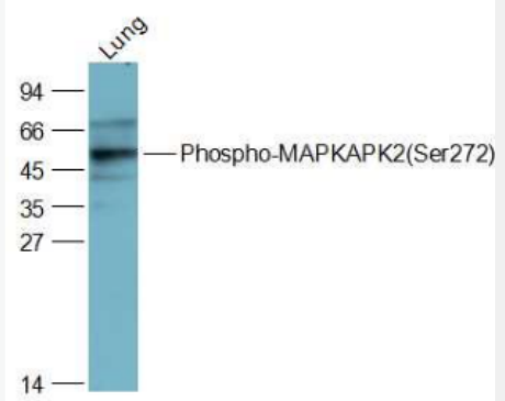 Anti-Phospho-MAPKAPK2 (Ser272) antibody-磷酸化丝裂原活化蛋白激酶活化的蛋白激酶2抗体,Phospho-MAPKAPK2 (Ser272)