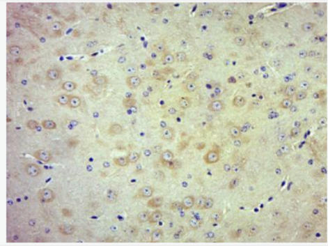 Anti-phospho-TrkB (Tyr705) antibody-磷酸化酪氨酸激酶B抗體,phospho-TrkB (Tyr705)