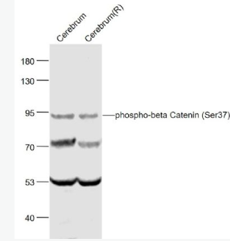 Anti-phospho-beta Catenin (Ser37) antibody-磷酸化β-連環(huán)蛋白/β-連環(huán)素/β鏈接素抗體,phospho-beta Catenin (Ser37)