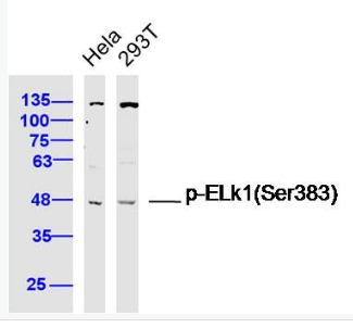 Anti-Phospho-ELk1 (Ser383) antibody-磷酸化细胞转录因子ELK1抗体,Phospho-ELk1 (Ser383)