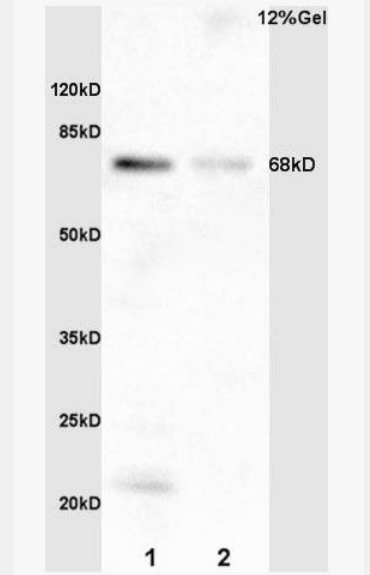 Anti-phospho-TCF3 (Ser39) antibody-磷酸化轉(zhuǎn)錄因子3抗體,phospho-TCF3 (Ser39)