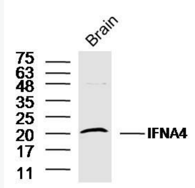 Anti-IFNA4  antibody-干擾素α4抗體,IFNA4