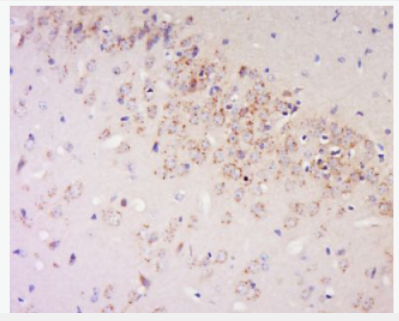 Anti-Klrb1c antibody-NKR-P1C（NK1.1）抗體,Klrb1c