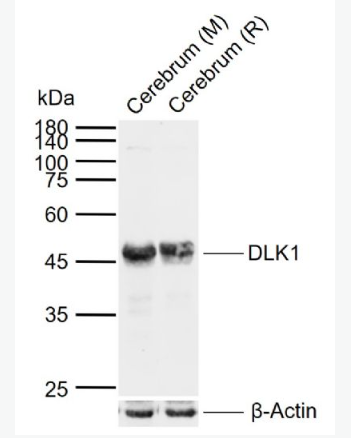 Anti-DLK1 antibody-穿膜蛋白DLK1抗體（C端）,DLK1