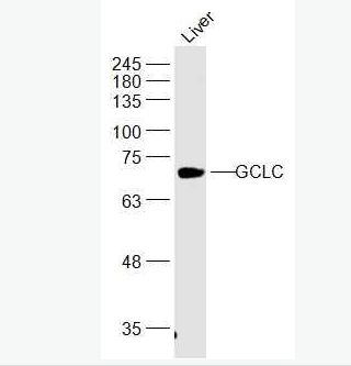 Anti-GCLC antibody-γ谷氨酰半胱氨酸合成酶抗体,GCLC