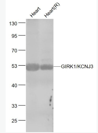 Anti-GIRK1/KCNJ3  antibody-G蛋白激活内向钾通道1抗体,GIRK1/KCNJ3