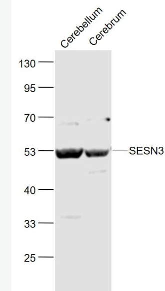 Anti-SESN3 antibody-Sestrin3抗体,SESN3