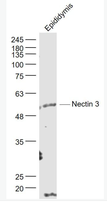 Anti-Nectin 3 antibody-连接蛋白3抗体,Nectin 3