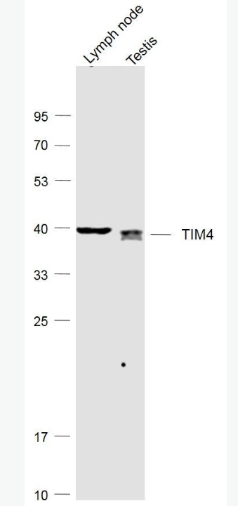 Anti-TIM4 antibody-T淋巴细胞膜蛋白4抗体,TIM4
