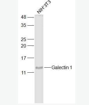 Anti-Galectin 1 antibody-半乳糖凝集素1抗体,Galectin 1
