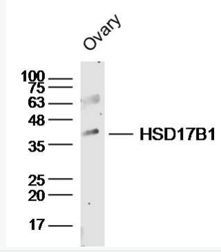 Anti-HSD17B1 antibody-羟类固醇脱氢酶17β抗体,HSD17B1