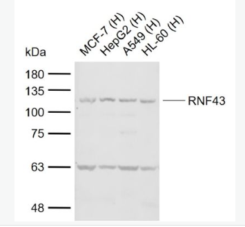Anti-RNF43  antibody-环指蛋白43抗体,RNF43