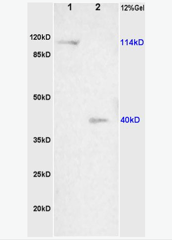 Anti-NALP3/CIAS1  antibody-细胞凋亡诱导蛋白NALP3抗体,NALP3/CIAS1