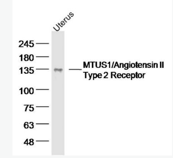 Anti-MTUS1 antibody-微管相关肿瘤抑制因子1 抗体,MTUS1