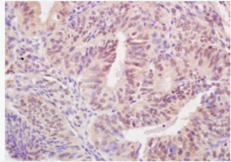 Anti-BARD1 antibody-乳腺癌易感基因环状结构域蛋白抗体,BARD1