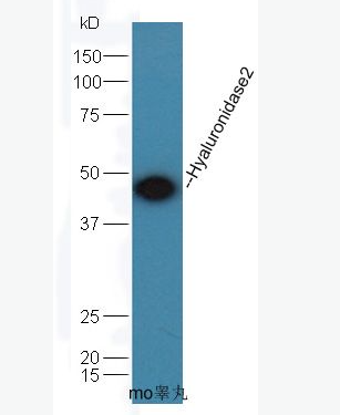 Anti-Hyaluronidase2 antibody-透明质酸酶2/玻璃酸酶2抗体,Hyaluronidase2