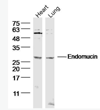 Anti-Endomucin  antibody-内皮粘蛋白EMCN抗体,Endomucin