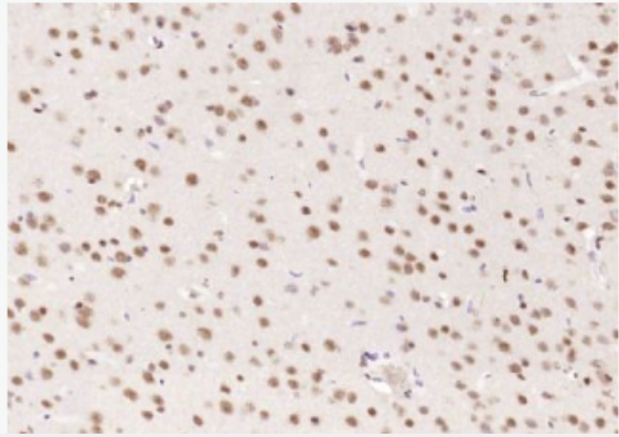 Anti-Alpha B Crystallin antibody-α晶狀體球蛋白B/αB-crystallin抗體,Alpha B Crystallin