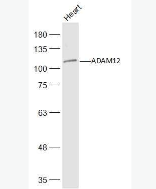 Anti-ADAM12 antibody-去整合素样金属蛋白酶12抗体,ADAM12