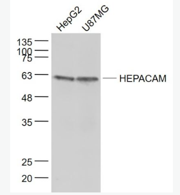 Anti-HEPACAM antibody-肝细胞粘附分子抗体,HEPACAM